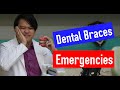 DENTAL BRACES EMERGENCIES? Mga Panandaliang Lunas sa Problema sa Braces (Orthodontic Emergencies) #5