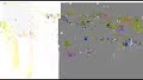 In any triangle ABC, if the angle bisector of `/_A` and perpendicular bisector of BC intersect, ...