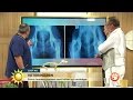 Veterinären: Så kan du upptäcka din stora hunds ledproblem - Nyhetsmorgon (TV4)