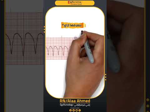 شرح   من حالات رسم القلب