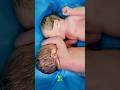 newborn twins baby are crying after fighting #shorts