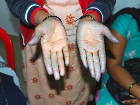 Why Women Garment & Footwear Sector Workers Face More Health Risks?