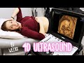 20 Week Pregnancy Anatomy Scan - 4D Ultrasound - She Knows The Gender Of Our Baby!