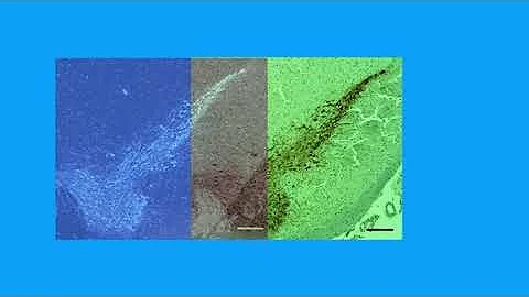 CC7A8BA168BF8DC1DA91C8B8AC36BC#1