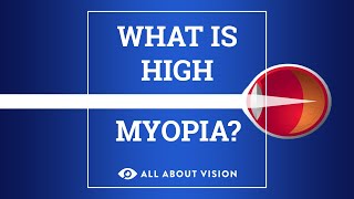 What is High Myopia?