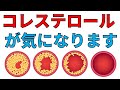 「コレステロールが気になります！」にお答えしました。はっしーの一問一答025