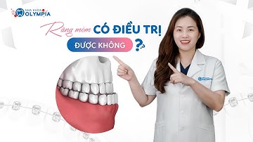Răng móm có NIỀNG được không? Bác sĩ chuyên niềng +8300 ca GIẢI ĐÁP CHI TIẾT!