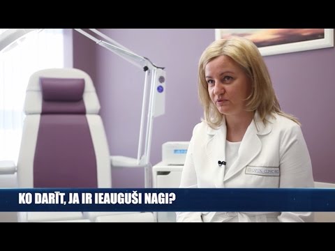 Video: Ieaugušu Nagu, Ko Darīt?