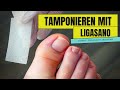 Eingewachsene Nägel und entzündete Zehen tamponieren mit Ligasano | So geht es!