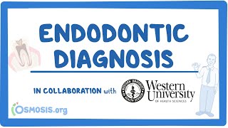 Endodontic Diagnosis (in Collaboration w/ Western University)