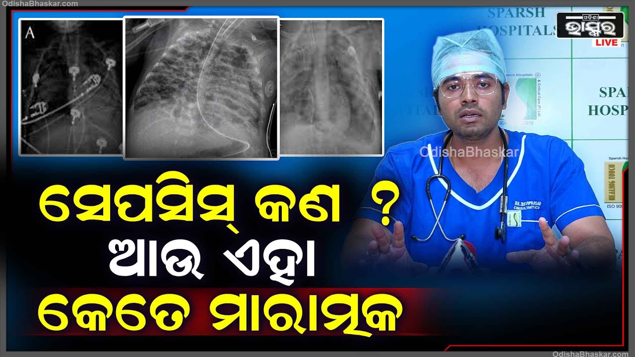 ସେପସିସ୍ କଣ ? ଆଉ ଏହା କେତେ ମାରାତ୍ମକ .. କଣ ରହିଥାଏ ଏହାର ଲକ୍ଷଣ ? Sepsis