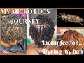 MY MICRO LOCS JOURNEY | Found LICE on my hair | DYEING my locs | blonde micro locs |  perfect grid