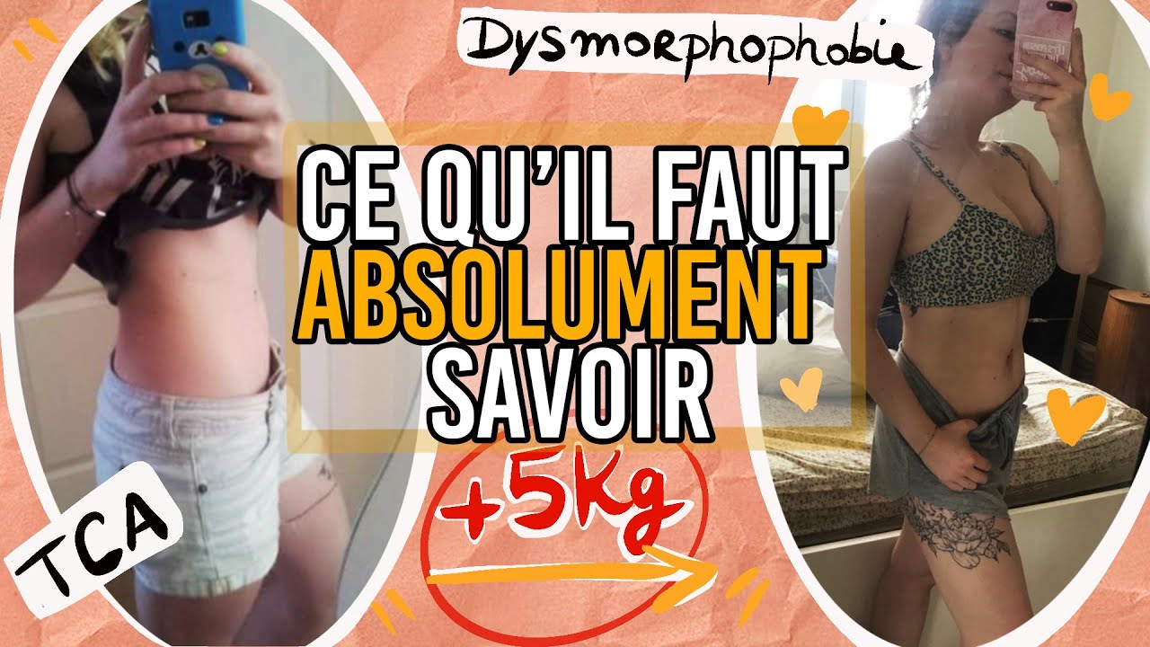 J'étais persuadée d'être GROSSE (Dysmorphophobie)