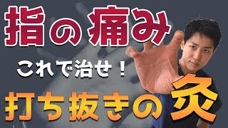 【指の痛み】お灸で解消！鍼灸師が徹底解説（概要欄に目次あり）