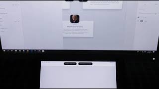 AdobeXD React Native code export with hot reloading
