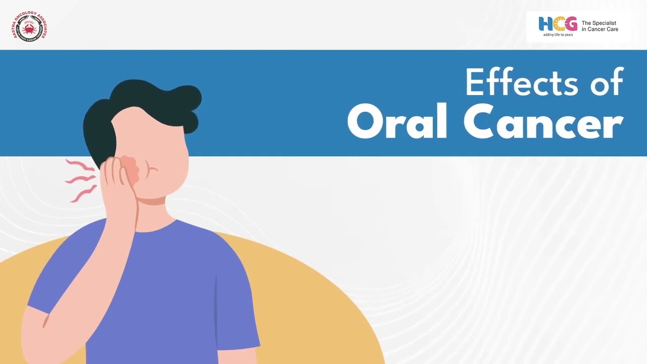 Effect of Oral Cancer: Insights from Dr. Aditya Joshipura at HCG Cancer Center, Ahmedabad.