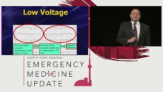 EMU 365 Series: Amal Mattu on killer ECGs