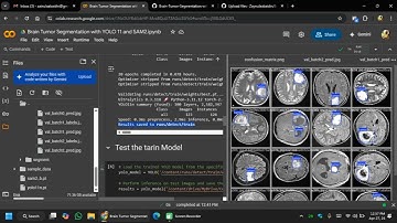Brain Tumor Detection and Segmentation using YOLO and SAM