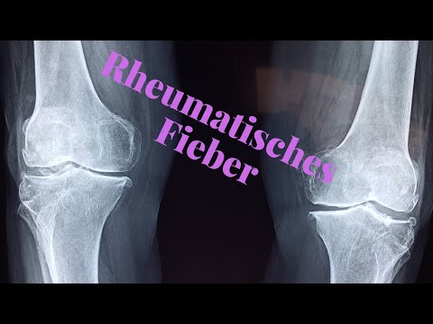 Video: Rheumatisches Fieber diagnostizieren – wikiHow