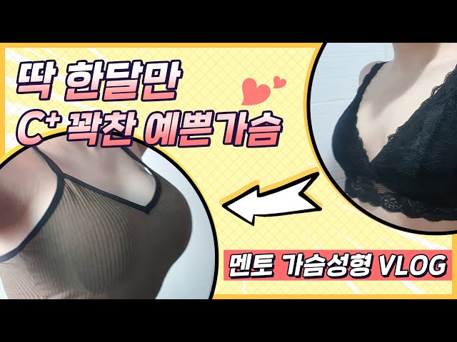 [KOR/ENG Sub]드디어 가슴성형수술 했습니다,풀C컵 됐어요! Victoria's Breast Augmentation Surgery Journey in Korea