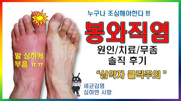 [봉와직염] 솔직후기 - 심하면 사망까지 이른다. 내성발톱, 무좀 상처 조심하세요!