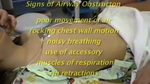 Recognizing Signs of Airway Obstruction in a Patient