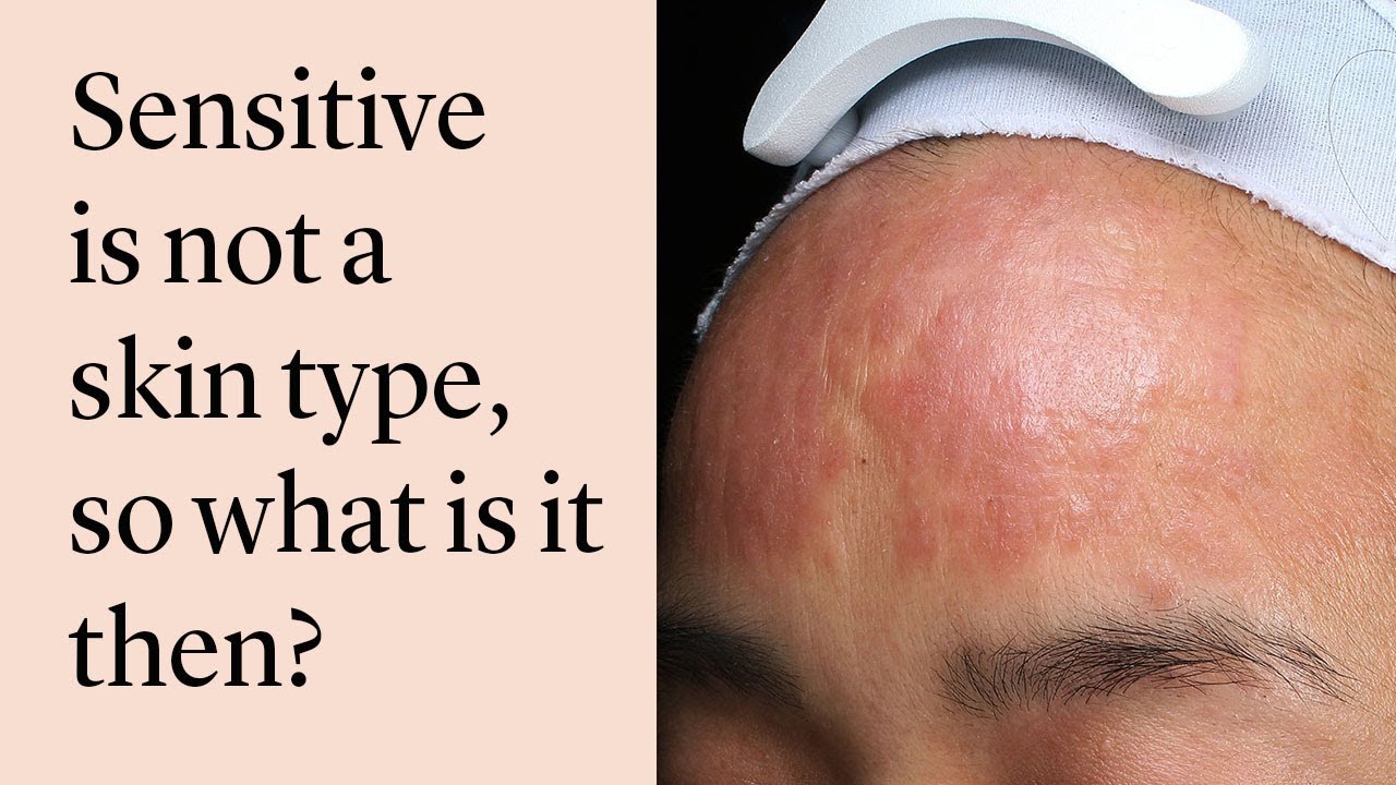 Is Your Skin As Sensitive As You Think We Learn The Causes Of