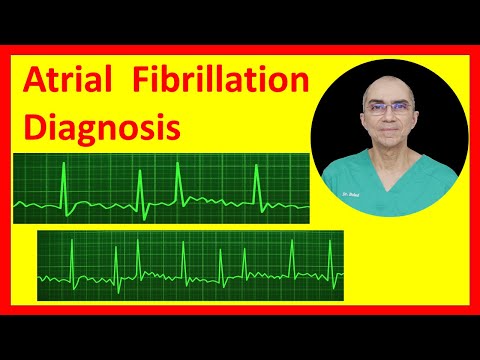 Video: Bolehkah fibrilasi atrium menjadi defibrilator?