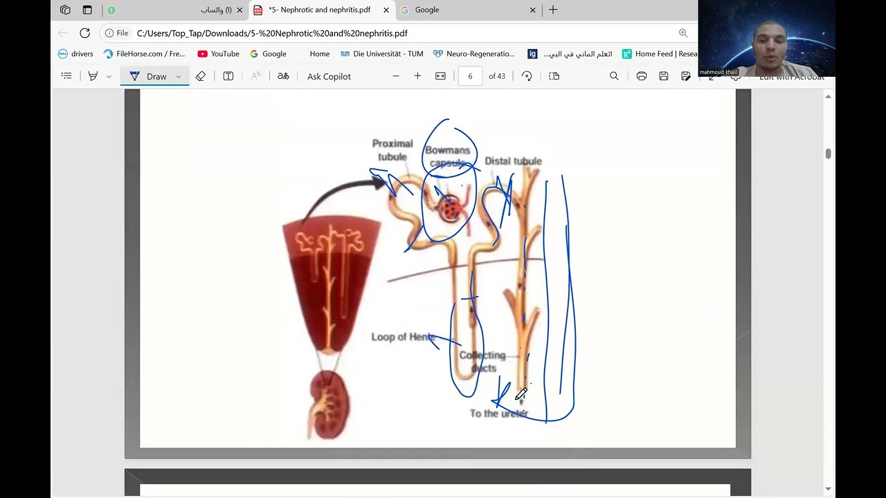 محاضرة الNephrotic and nephritic syndrome