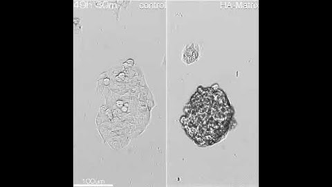 (33)The HepG2 aggeregation by using HA-Matrix. (Obj=10x)