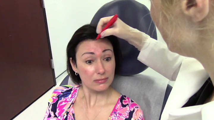 Vol.2: Botox Injections into Forehead with Dr. Jen...