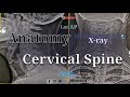 Anatomy of Cervical Spine X-rays AP/Lat | By Anis Qureshi