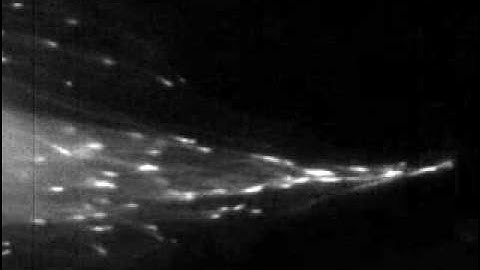 Microtubule Dynamics