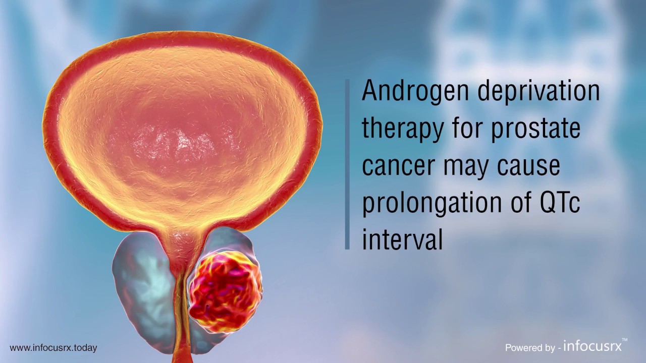Androgen deprivation therapy for prostate cancer causes prolongation of