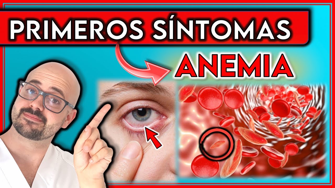 ESTOS son PRIMEROS SÍNTOMAS de la ANEMIA || ¡Indican ANEMIA SEVERA! - YouTube