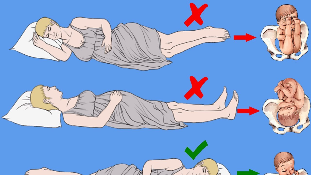 وضعيات نوم خاطئة للحامل تضر بالجنين ما هي وضعية النوم الصحيحة للحامل Youtube
