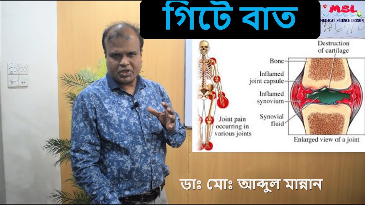 গেঁটে বাত বা সন্ধিবাত Rheumatoid arthritis Bangla Dr Abdul Mannan