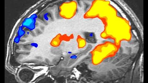 fMRI BrainScan: SideView