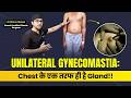 One-Sided Gynecomastia Surgery for Army Candidate | Unilateral Gyno | Dr DC, Plastic Surgeon