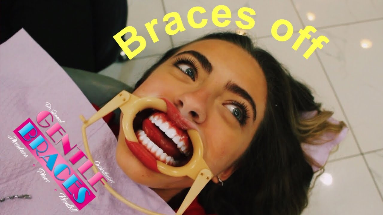 Getting my braces off!!! || Valeria Arguelles