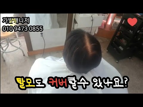 @앞머리가발@정수리가발@탈모커버할수 있나요?