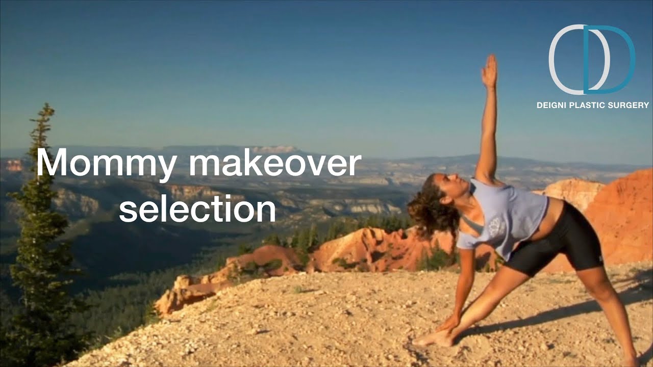 Can I fix multiple things at once during a mommy makeover? | Q&A with Dr. Deigni