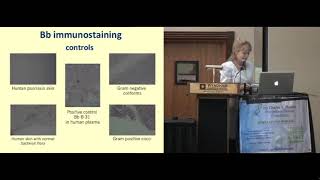 Morgellons Disease: What's Relevant, What Isn't? Marianne Middleveen, MDES
