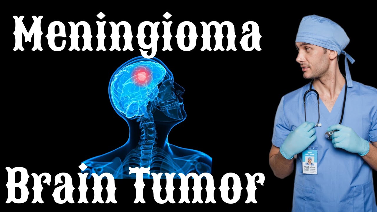 brain-tumor-meningioma-detailed-information-about-treatments