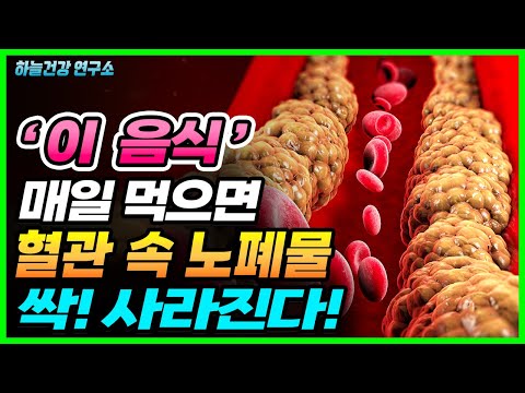 꽉 막히고 <strong>더러워진</strong> 혈관 깨끗하게 청소하는 이 음식 매일 드세요! (혈관에 좋은 음식)