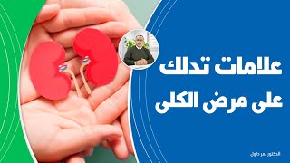 علامات مبكرة لأمراض الكلى | عندما تكون الكلى في خطر سيعطيكم الجسم هذه العلامات المهمة كن حذرا وانتبه