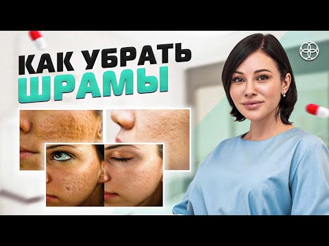 Рубцы и Шрамы | Методы лечения шрамов и рубцов | СОВЕТ КОСМЕТОЛОГА