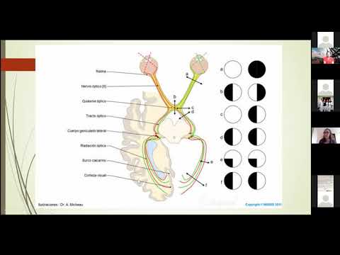 Vídeo: Efectos Hemodinámicos De La Contrapulsación Externa Mejorada En Las Arterias Cerebrales: Un Estudio Multiescala