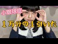 １万分の１の確率で目の無い子供が産まれます
