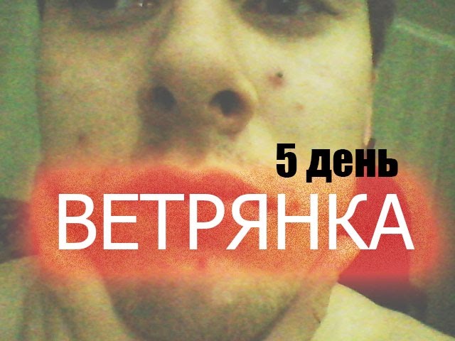 Ветрянка и её стадии. 5 День. Ветрянка отзывы